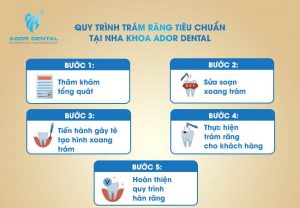 Quy trình trám răng tiêu chuẩn tại nha khoa ADOR