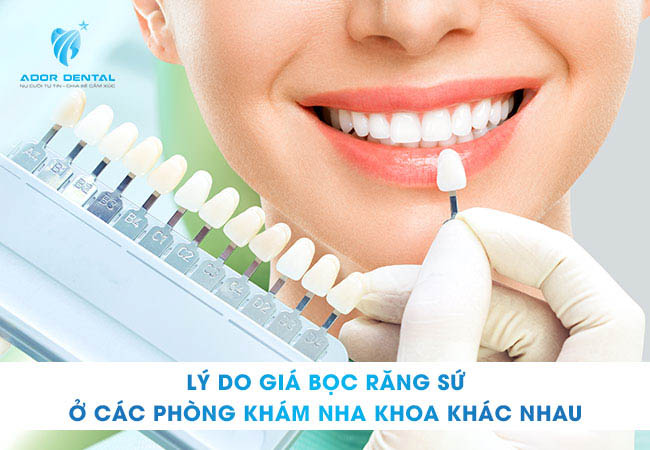 giá bọc răng sứ ở các phòng khám nha khoa khác nhau