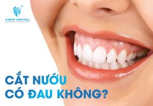Cắt nướu có đau không?
