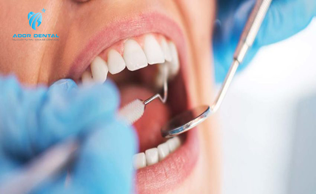 Chữa tủy răng bị đau nhức là phổ biến tuy nhiên đã có thuốc tê giúp kháng đau