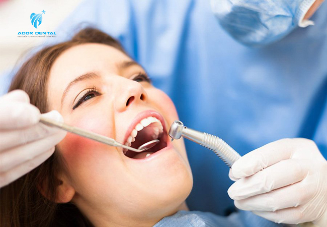 Sau khi chữa tủy răng cần kiêng cứ theo hướng dẫn để đạt kết quả điều trị