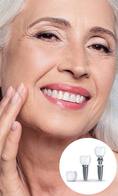 Dịch vụ cay implant