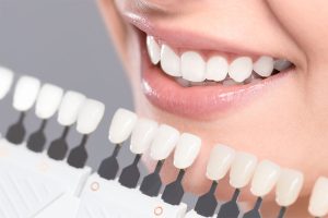 bọc răng sư 16 chiếc